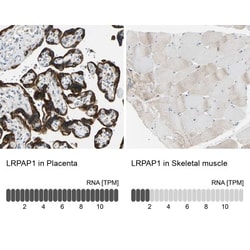 LRPAP Antibody, Novus Biologicals 0.1mL; Unlabeled:Antibodies, Polyclonal